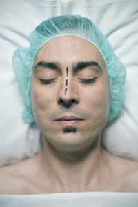 Beyond Size: Discover the Surprising Benefits of Nose Surgery!