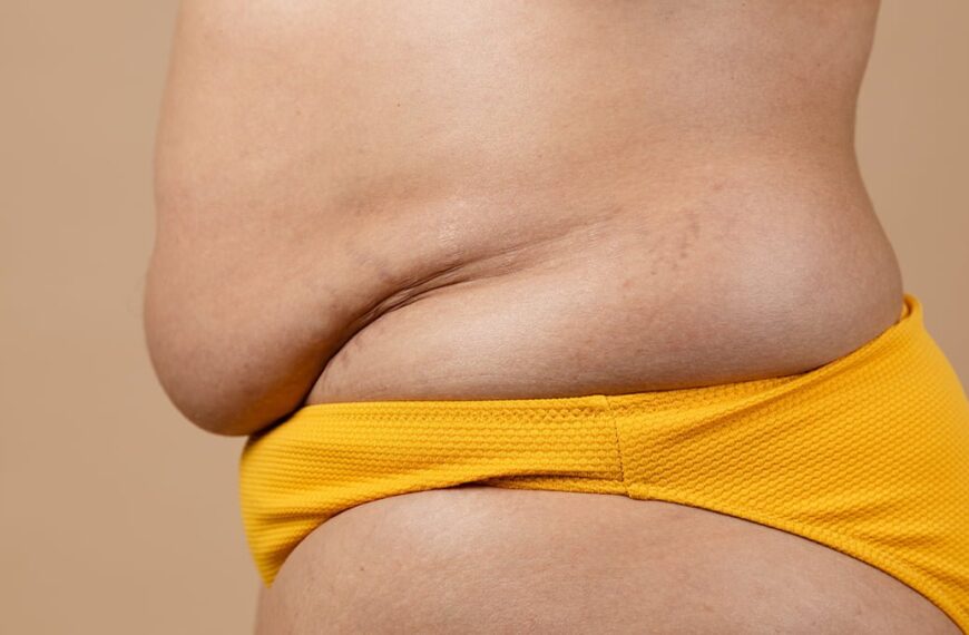 Choosing the Perfect Tummy Tuck: Your Guide to the Right Procedure for a Flatter Abdomen