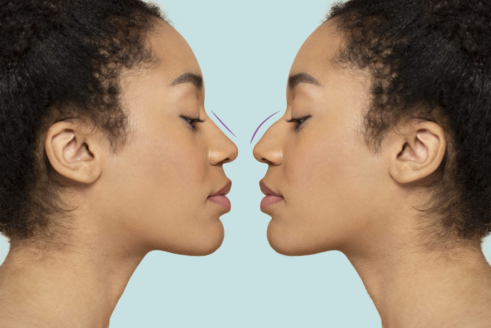 Essential FAQs About Nasal Septum Perforation Surgery: Your Comprehensive Guide