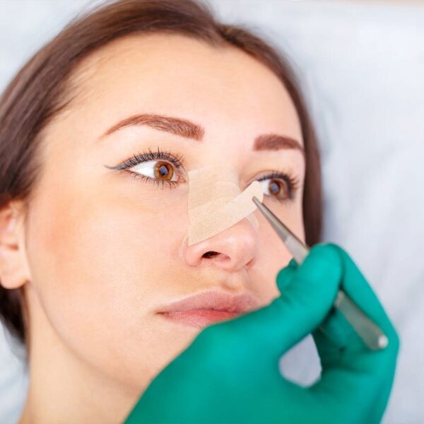 Essential Rhinoplasty Recovery Tips: What to Avoid After Surgery