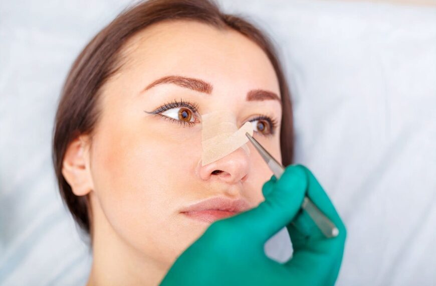 Essential Rhinoplasty Recovery Tips: What to Avoid After Surgery