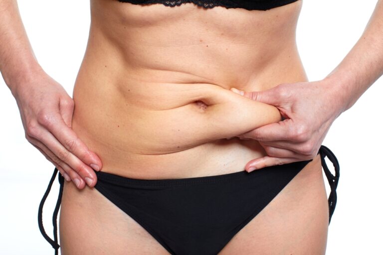 Finding Your Perfect Tummy Tuck: A Guide to Choosing the Right Procedure for Your Body