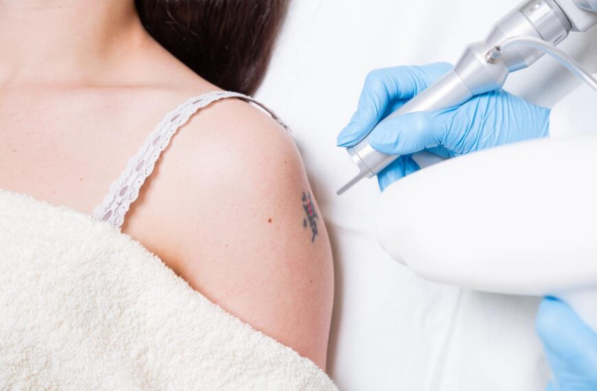 Laser Tattoo Removal: Why Choosing a Doctor Could Be Your Best Decision!