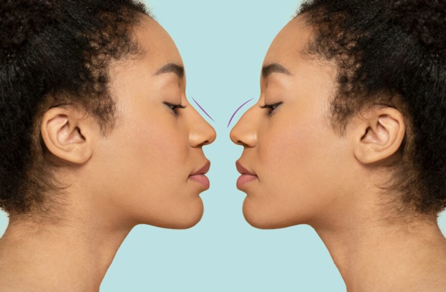 Rhinoplasty vs. Septoplasty: Discover the Perfect Nose Makeover for You!