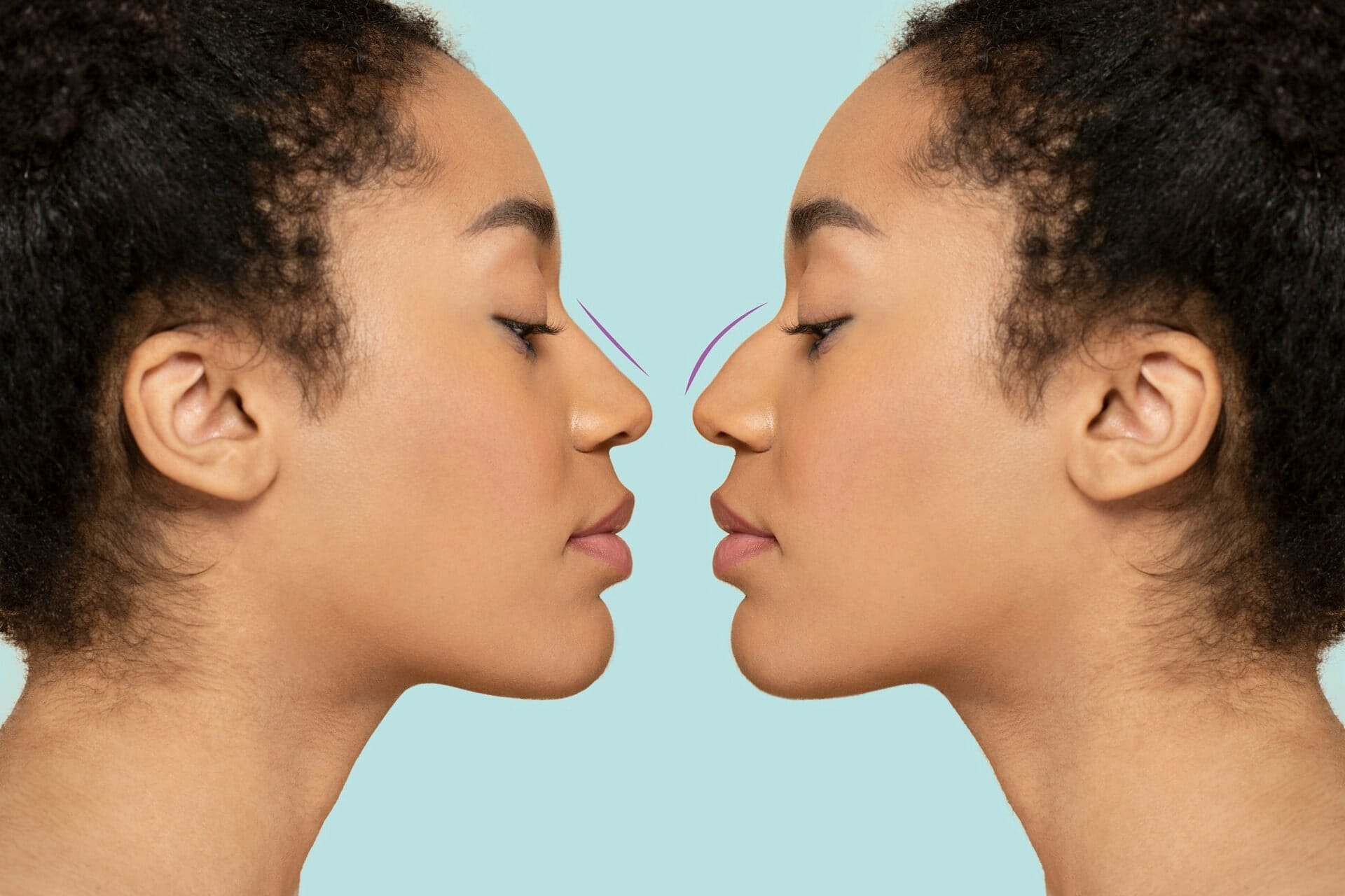 Rhinoplasty vs. Septoplasty: Discover the Perfect Nose Makeover for You!