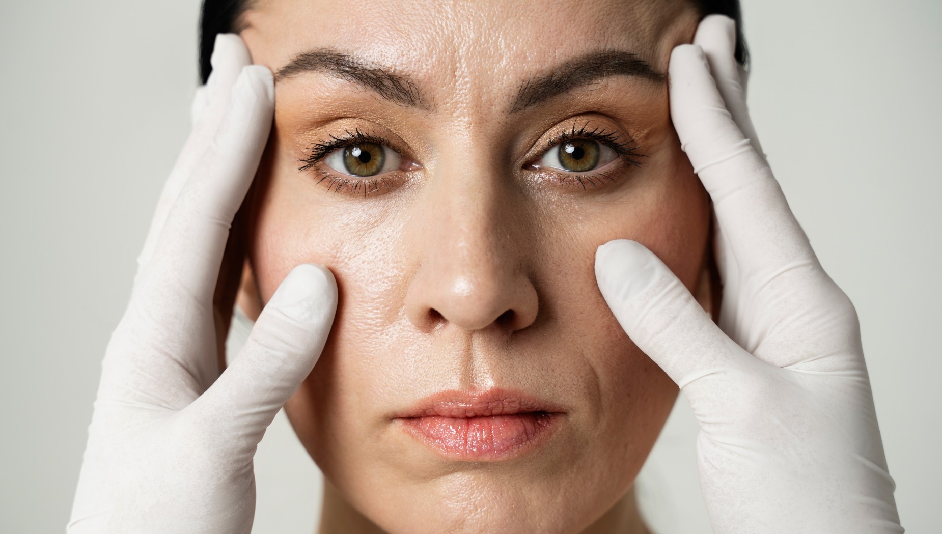 Top Dermal Fillers for Smooth Nasolabial Folds: Discover the Best Options!