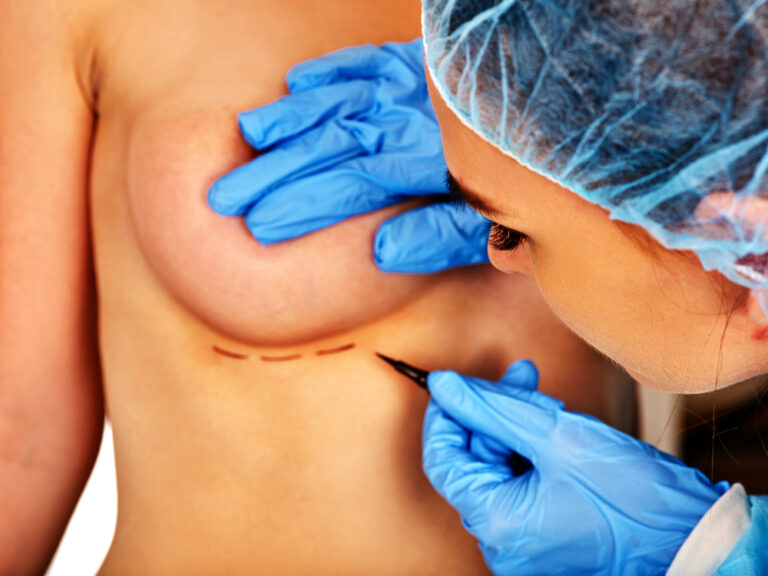 Understanding Breast Augmentation: Types of Scarring You Might Experience