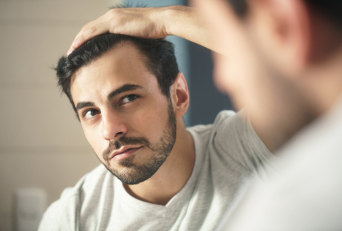 Unlock a Gorgeous Hairline: Top Tips for Hair Growth and Restoration