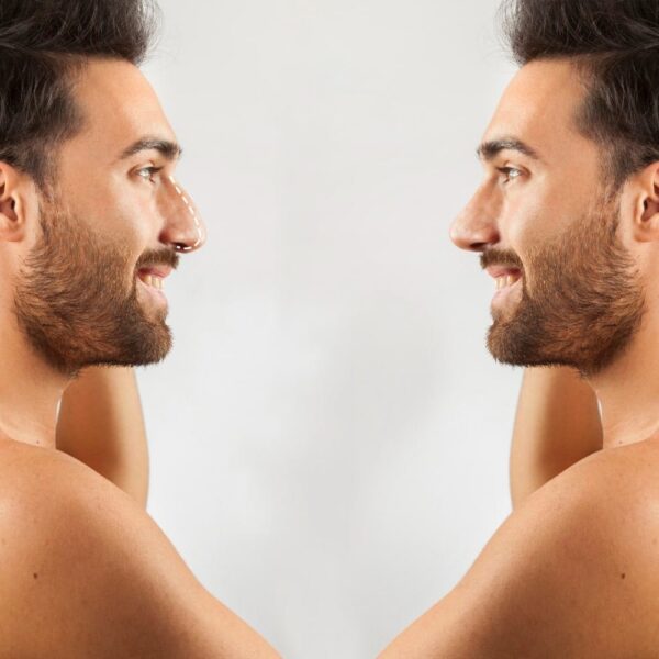 Unveiling the Reasons: Why Men Hesitate to Embrace Cosmetic Surgery