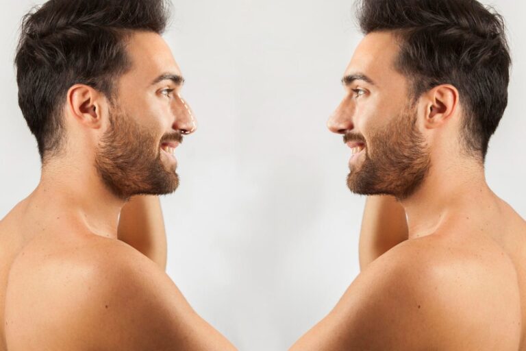 Unveiling the Reasons: Why Men Hesitate to Embrace Cosmetic Surgery