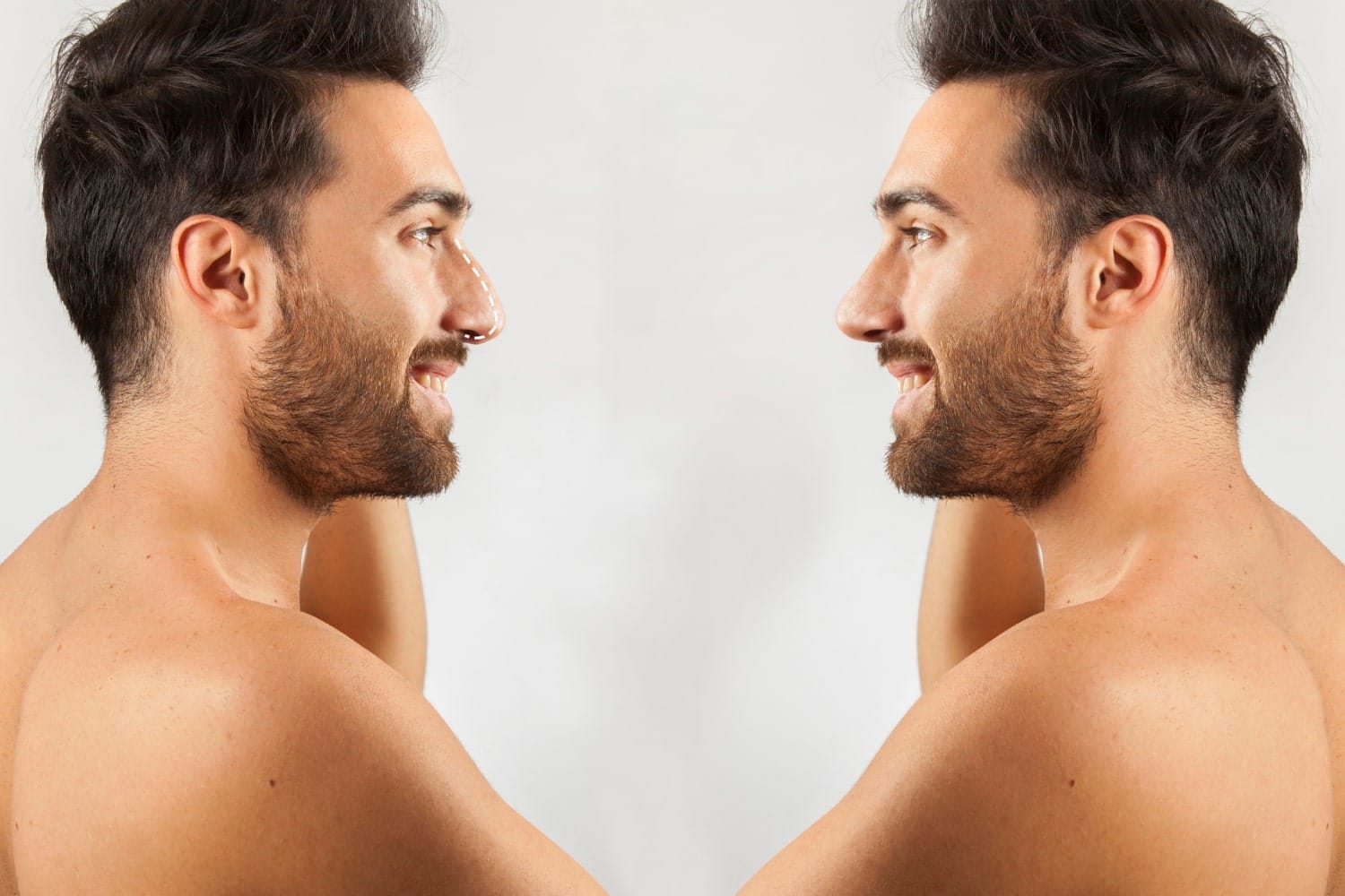 Unveiling the Reasons: Why Men Hesitate to Embrace Cosmetic Surgery