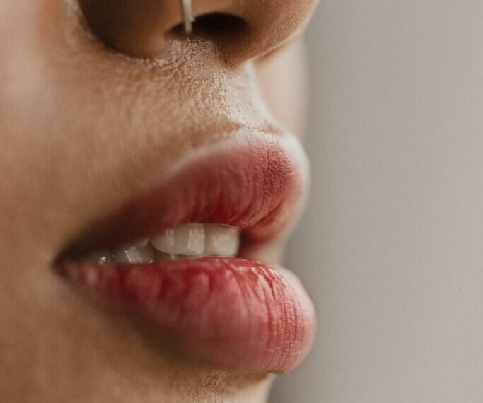 Everything You Need to Know About Lip Lift Surgery: Procedure, Benefits, and Recovery