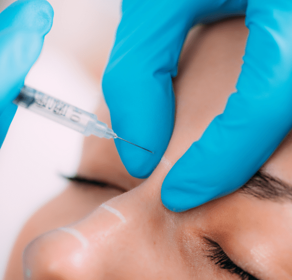 Non-Surgical Nose Job: Discover the Longevity of Your Results!