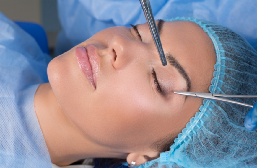 Revitalize Your Look: Transformative Upper Eyelid Surgery for a Youthful and Bright Appearance