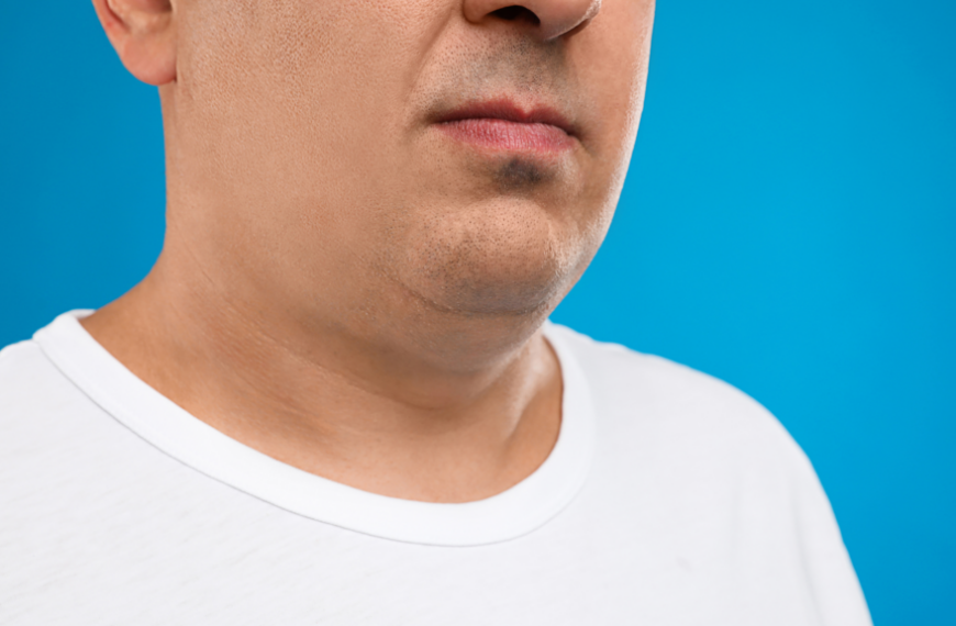 Say Goodbye to Double Chin: Effective Techniques for Sculpting a Defined Lower Face