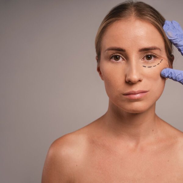 Top Signs It's Time for Blepharoplasty: Discover When to Consider Eyelid Surgery