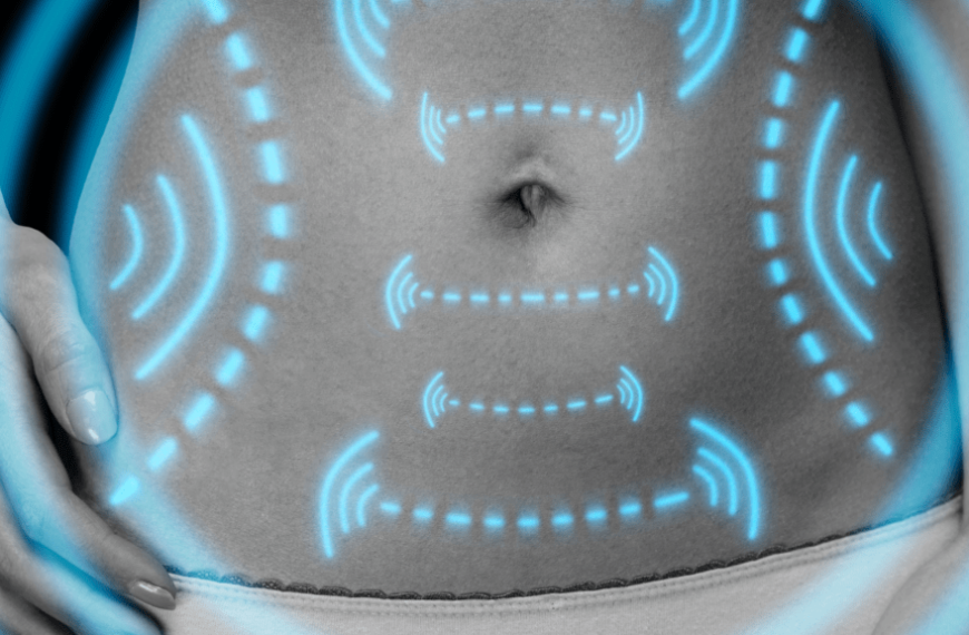 Transform Your Body: Mastering High-Definition Liposuction for a Sculpted, Athletic Look
