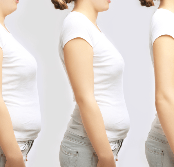 Transform Your Figure: The Impact of Weight Loss on Your Breast Lift Results