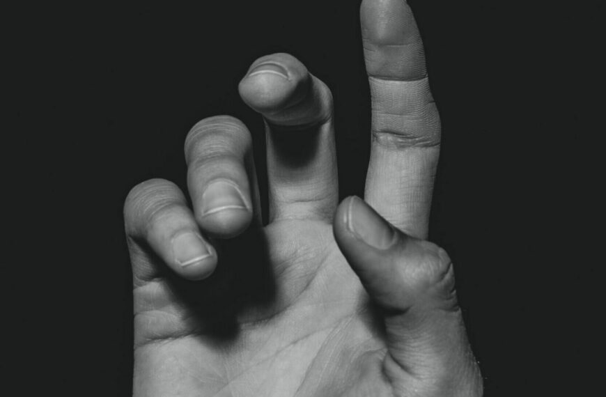 Trigger Finger vs. Dupuytren's Contracture: Key Differences You Need to Know!