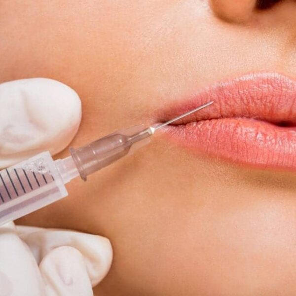 Unlock the Secrets of Lip Filler Injections: Discover Their Lasting Effects!