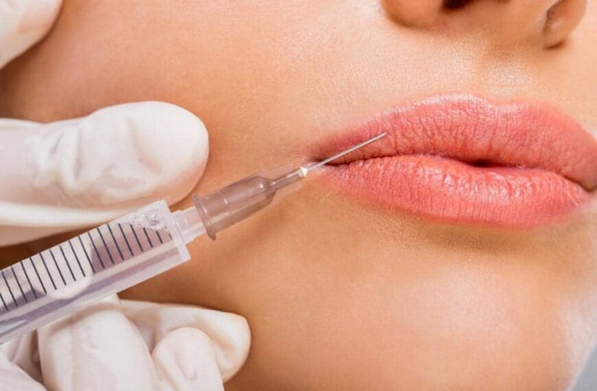 Unlock the Secrets of Lip Filler Injections: Discover Their Lasting Effects!