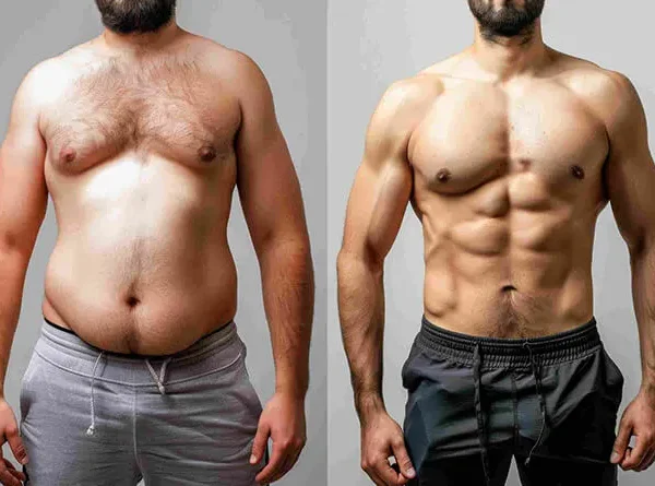 Will Gynecomastia Surgery Leave Me with Loose Skin? Find Out What to Expect!