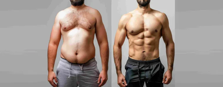 Will Gynecomastia Surgery Leave Me with Loose Skin? Find Out What to Expect!