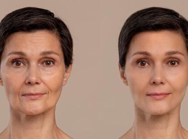 Essential Guide: What to Expect from Your Facelift Journey