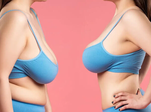 Revitalize Your Confidence: Top Solutions for Perky Breasts After Pregnancy